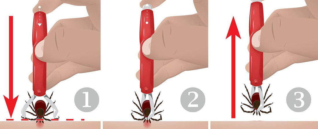 valonic tick Remover, 2 Pack - red, tick Removal Tool