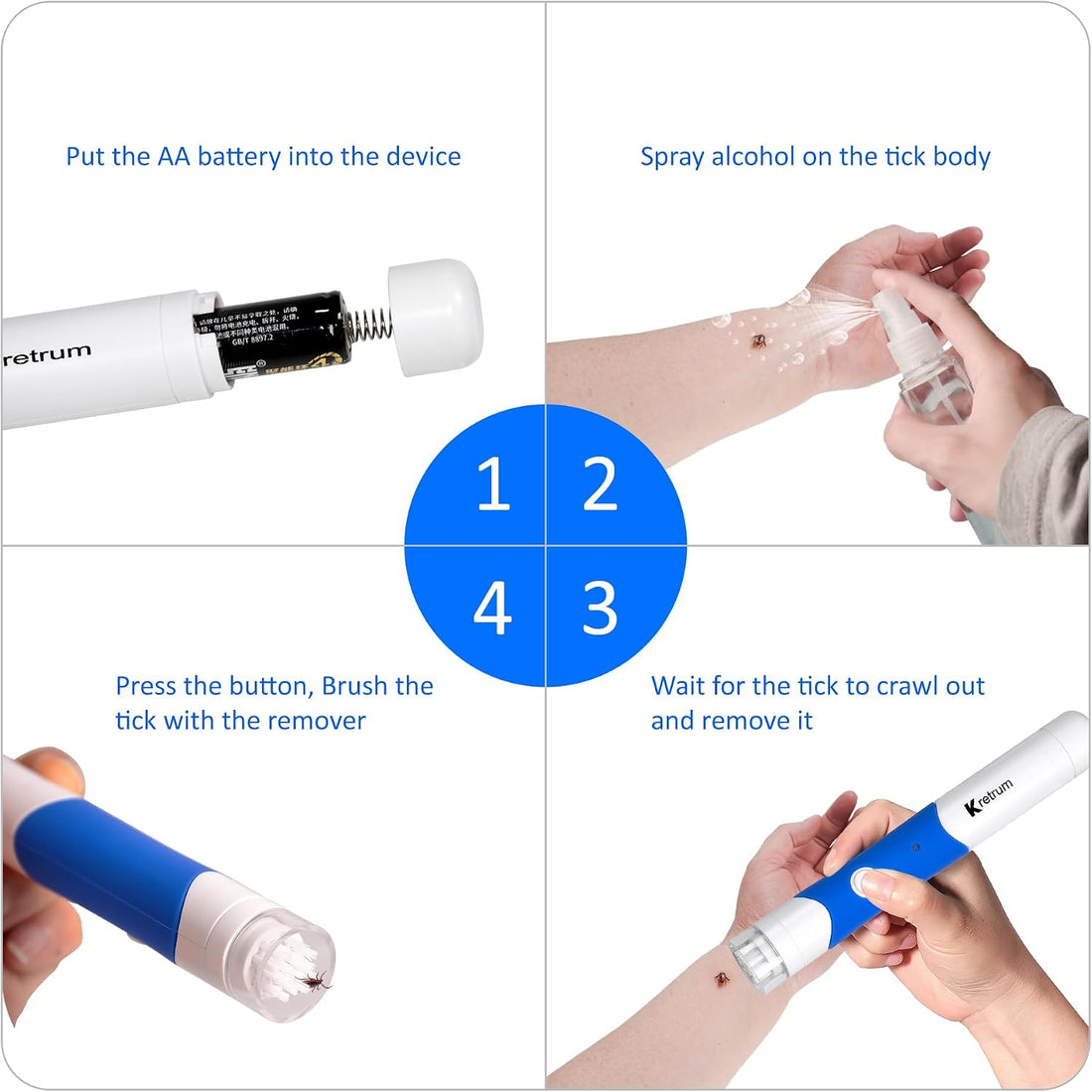 Kretrum Tick Removal Tool Pen Premium Auto Tick Remover Tool for Dogs