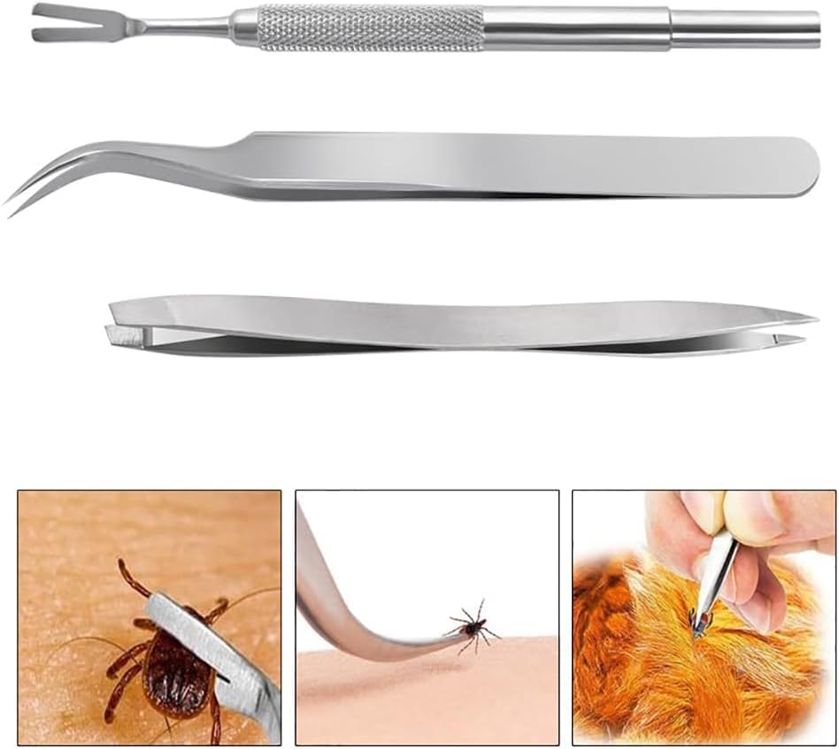 2Pcs Silver Stainless Steel Tick Tweezers Dual Tipped Tick Remover