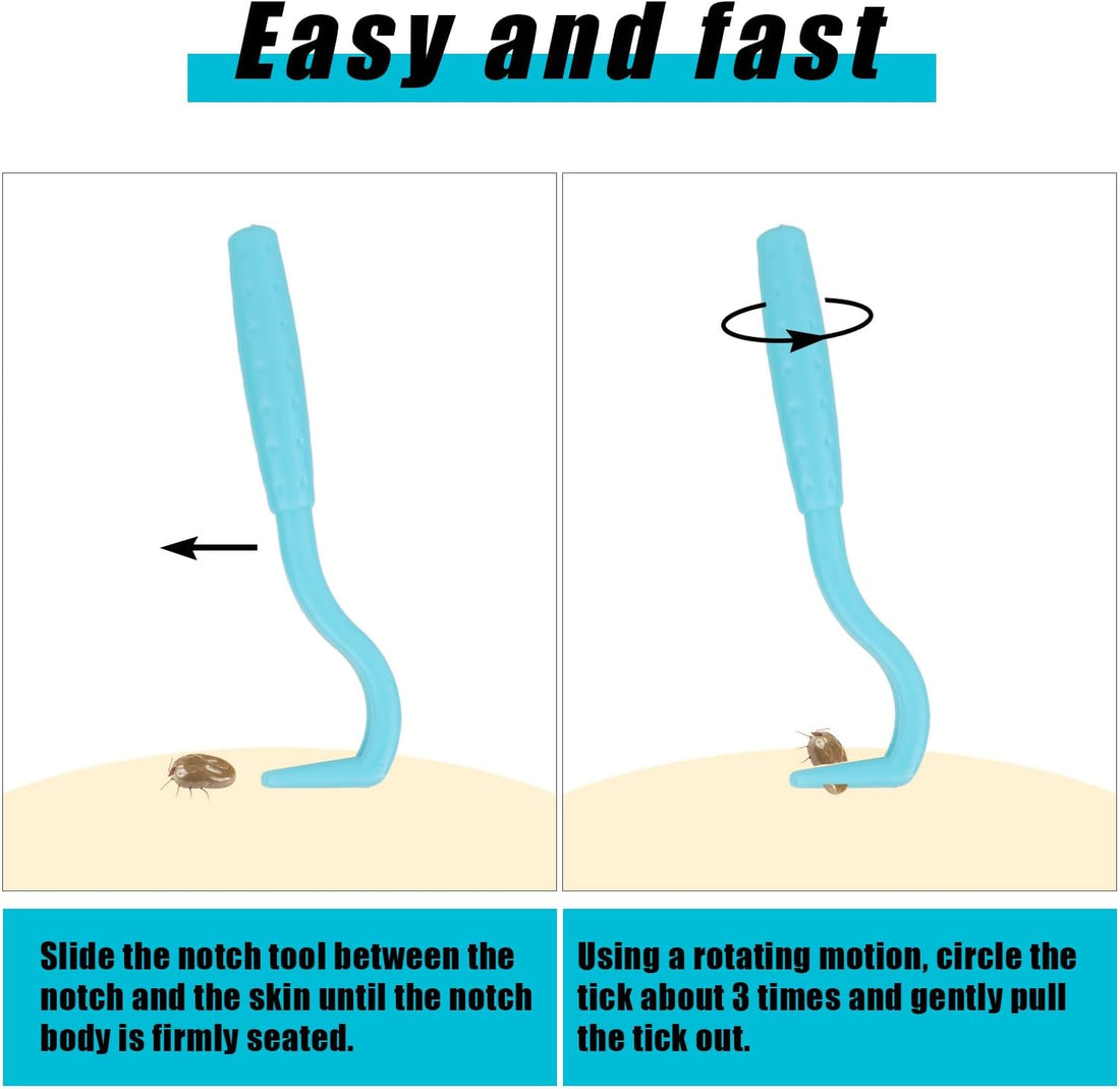 BOXOB 3pcs Tick Remover Tools