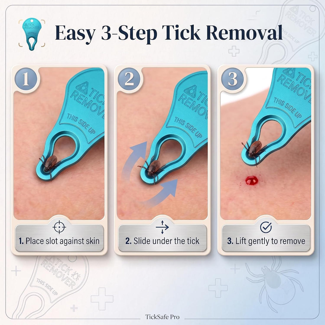 Tick Remover Tool 3 Pack | Aluminum Key for Dogs & Humans