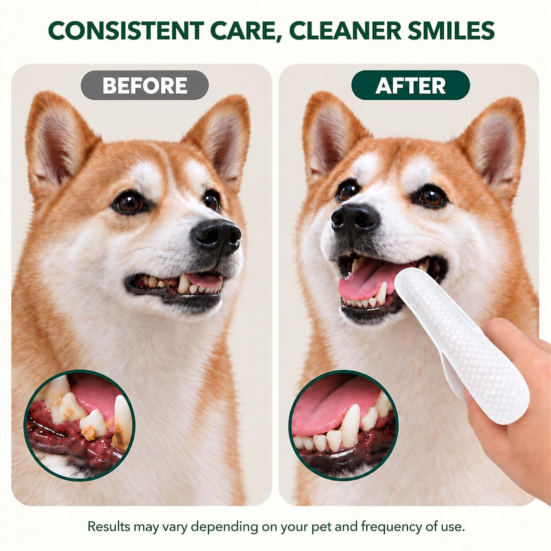 Extra-Long Dental Finger Wipes with Split Opening