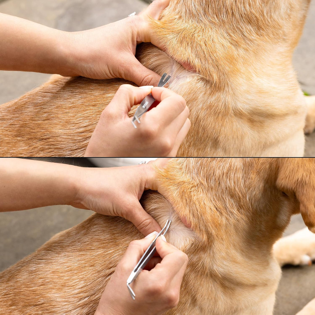Tweezerman Precision Dual-Sided Tick Removal Tweezer & Case